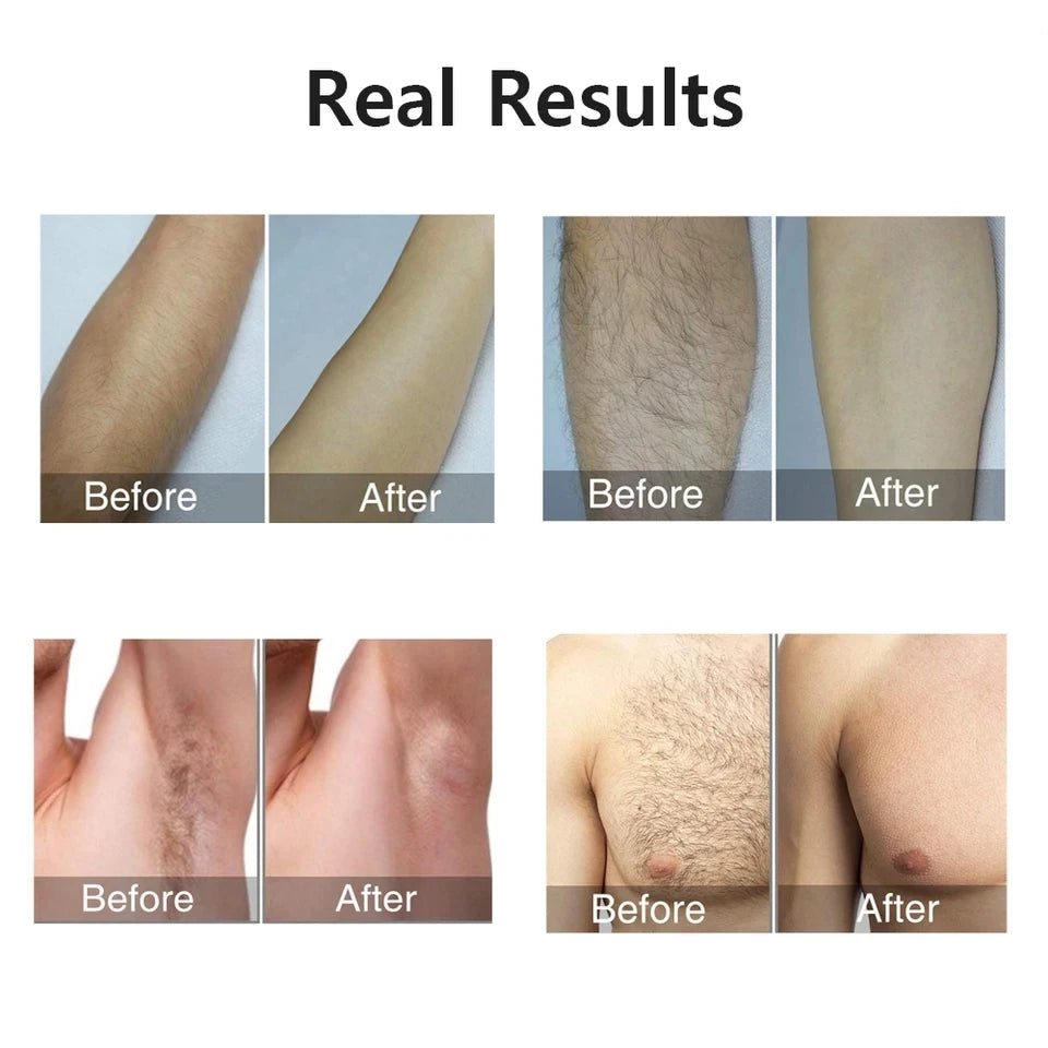 Mini IPL Laser Epilator – Painless Hair Removal at Home