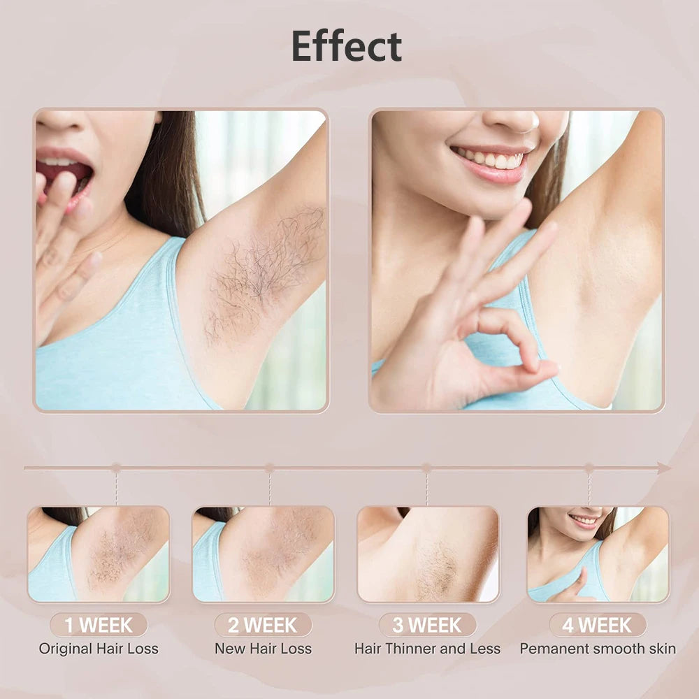 Mini IPL Laser Epilator – Painless Hair Removal at Home